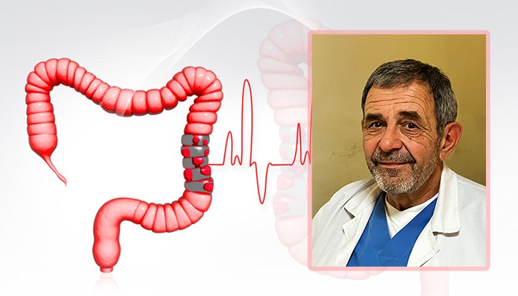 Д-р Йосиф Новаков: Ракът на дебелото черво е второто най-често срещано онкологично заболяване