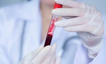 Учени са напът да изобретят универсална нулева кръвна група