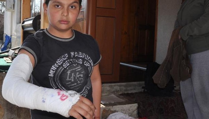 Учителка потроши ръката на петокласник със сопа Учителка потроши ръката на петокласник със сопа