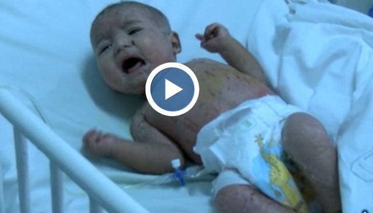 Жена натрива 2 месеца новороденото си със сол, лекари се борят за живота му