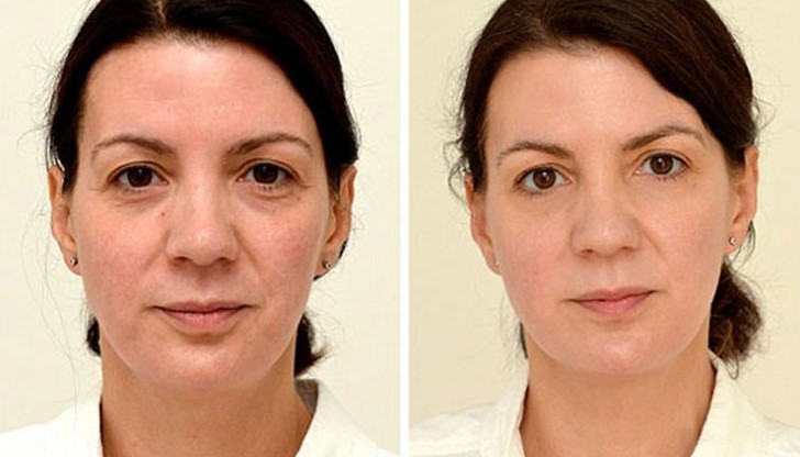 3 литра вода на ден подмладяват с 10 години