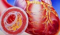 Суперхапче унищожава холестерола в организма