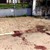 Почина жената, която беше разкъсана от питбули в Червена вода