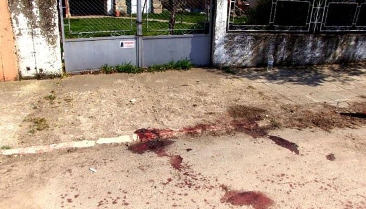 Почина жената, която беше разкъсана от питбули в Червена вода