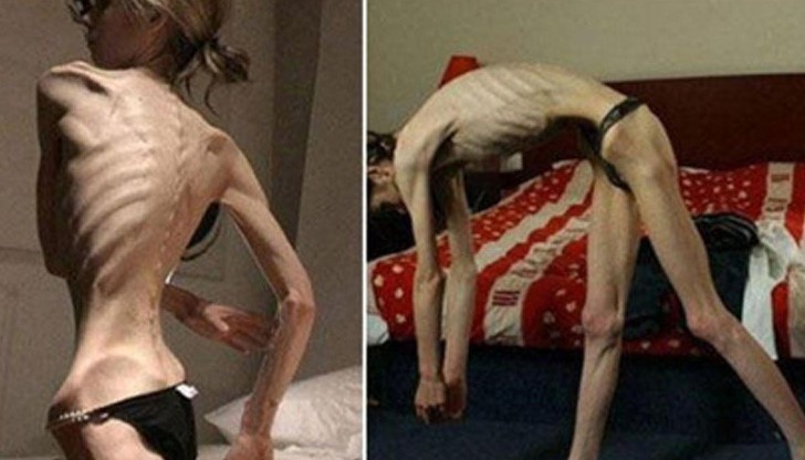 Не правете така! 20-годишна красавица се превърна в мумия Не правете така! 20-годишна красавица се превърна в мумия