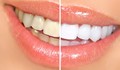 3 лесни метода за избелване на зъбите в домашни условия