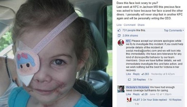 Изхвърлиха обезобразено от питбули дете от заведение на KFC