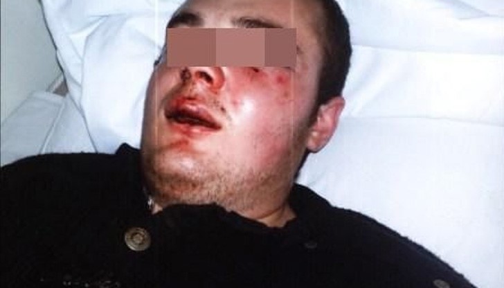 Потрошиха мъж заради 40 лв. ресто за кокаин Потрошиха мъж заради 40 лв. ресто за кокаин