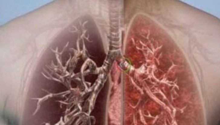 3 супер ефикасни начина за пречистване на белите дробове от цигарите