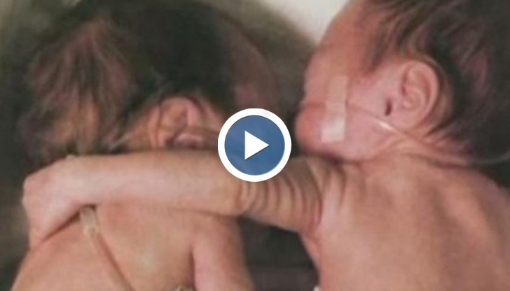 Прегръдката върши истински чудеса