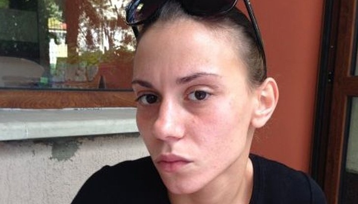 Момичето, което бе залято с блажна боя за отмъщение: Болките бяха нечовешки! Момичето, което бе залято с блажна боя за отмъщение: Болките бяха нечовешки!