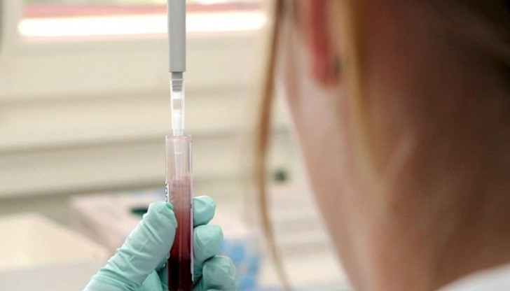 Създадоха уникален кръвен тест, който диагностицира рак