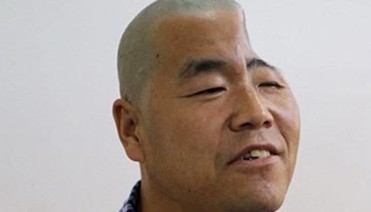 46-годишният Ху Вей паднал от триетажна сграда и почти размазал черепа си