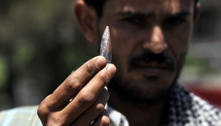 Барат Шарма показва извадения от сърцето му куршум