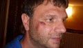 Мъж се оплака във Фейсбук от полицейски побой