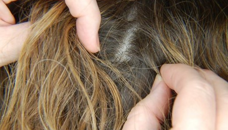 а появата на въшки в русенски детски градини сигнализирали разтревожени майки а появата на въшки в русенски детски градини сигнализирали разтревожени майки