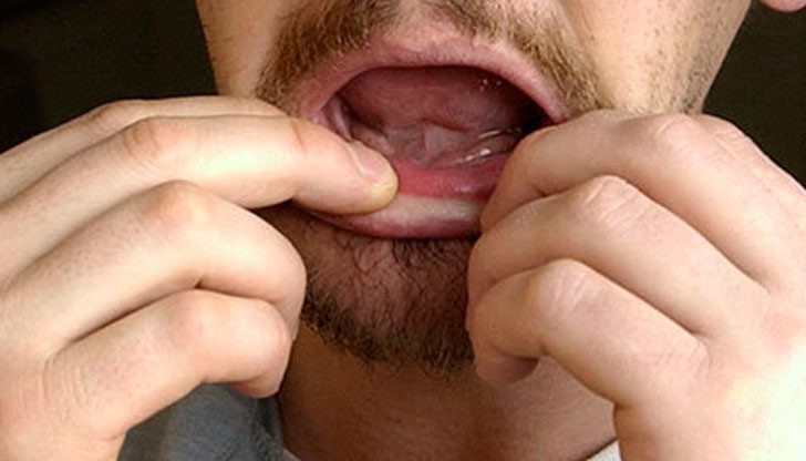 1 млн. българи са без зъби и като основна причина посочват, че нямат пари да посещават зъболекар 1 млн. българи са без зъби и като основна причина посочват, че нямат пари да посещават зъболекар