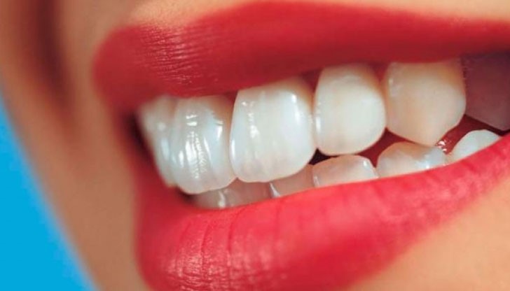 Няколко рецепти за отстраняване на зъбен камък Няколко рецепти за отстраняване на зъбен камък