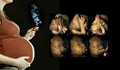 Ултразвук показва какво се случва с бебето, когато майката пуши