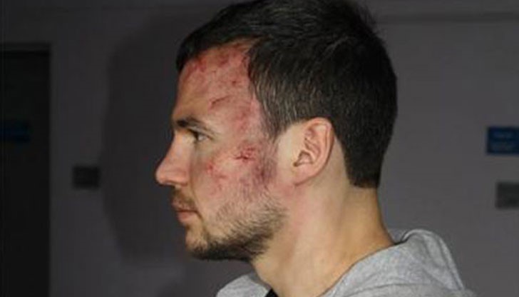 Ивайло Захариев претърпява сериозен инцидент. Ранен е и трябва спешно да постъпи в болница