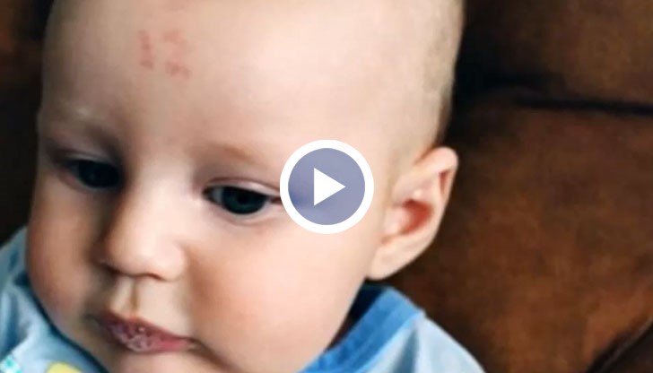 Бебе с дванадесетица на челото хвърли в смут лекари и родителите му