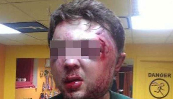 Баща и син от ромски произход отвлекли от дома му търговец на животни и след 4 часа зверски бой и заплахи, че ще подпалят него и семейството му, го хвърлили в снежните преспи