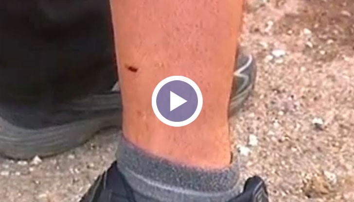 Нахапан от куче русенец