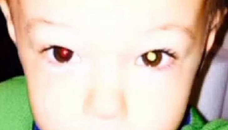 Когато майката направила снимка със светкавица с iPhone на сина си, , тя открила нещо странно в лявото му око