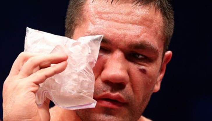 Разходите на НЗОК нарастват с много по-бърз темп от приходите от здравно-осигурителни вноски.