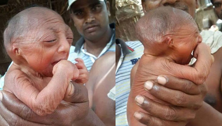 Роди се момченце, което прилича на старец. Майката отказва да го храни. Бог да благослови това бебе!