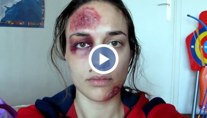 Помогнете ми, не зная ще оживея ли до утре, моли младата жена