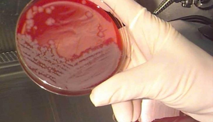 Уведомени са Регионалната здравна инспекция и Министерството на здравеопазването