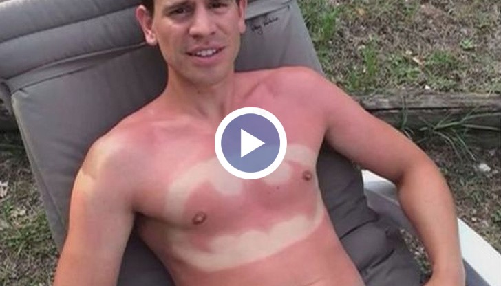 Умишлено слънчево изгаряне