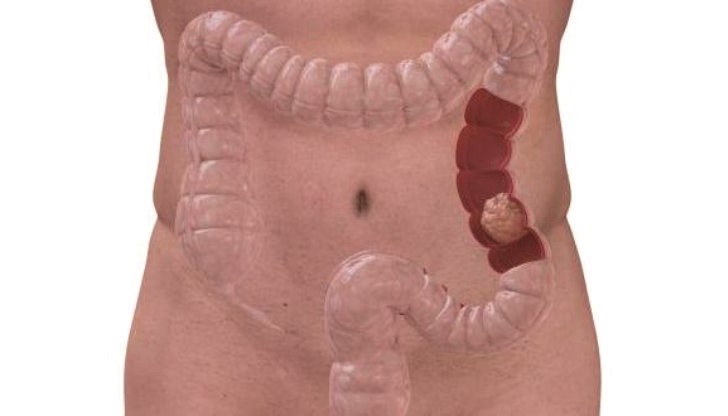 Учени от World Cancer Research фонд заявиха ...