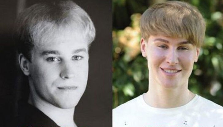 Тоби Шелдън е похарчил 100 000 долара за пластични операции, за да изглежда като поп звездата Джъстин Бийбър