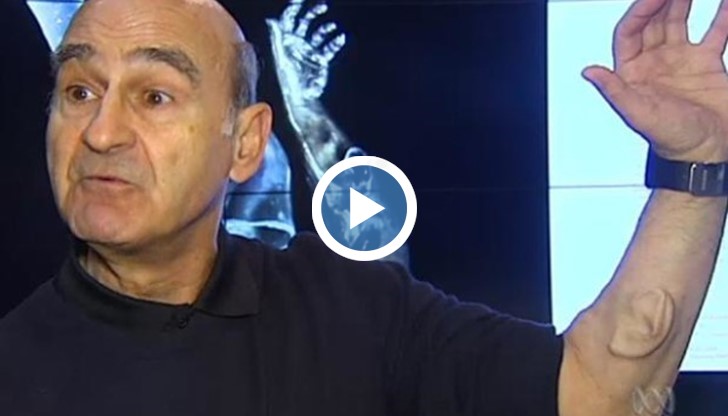 Австралийски изпълнител на забавни програми е имплантирал ухо в ръката си