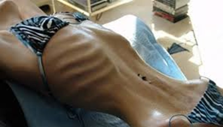 Болестта, установена навреме, се лекува, а у нас има добри специалисти