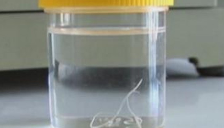 Български лекари направиха уникална операция у нас Български лекари направиха уникална операция у нас