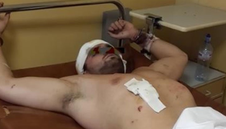 Английският Хълк бе окован за болничното легло с два броя белезници и с вързани крака Английският Хълк бе окован за болничното легло с два броя белезници и с вързани крака