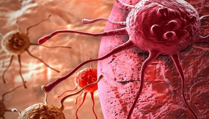 Американски изследователи създадоха имплант, който да може да побеждава ракови клетки