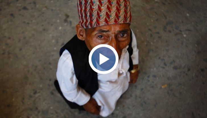 Най-малкият човек на света почина в болница на 76 години