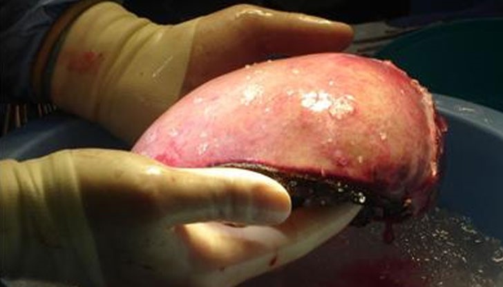 За целта джихадистите открили специализирана клиника в иракския град Мосул За целта джихадистите открили специализирана клиника в иракския град Мосул