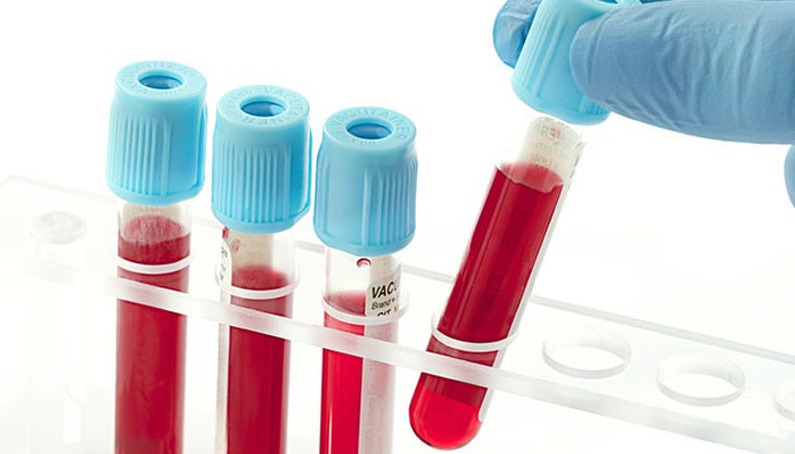 Тестът определя риска ни от деменция и истинската ни биологична възраст