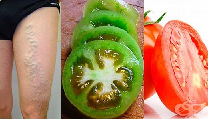 Доматът насърчава кръвообращението и укрепва кръвоносните съдове по един естествен начин