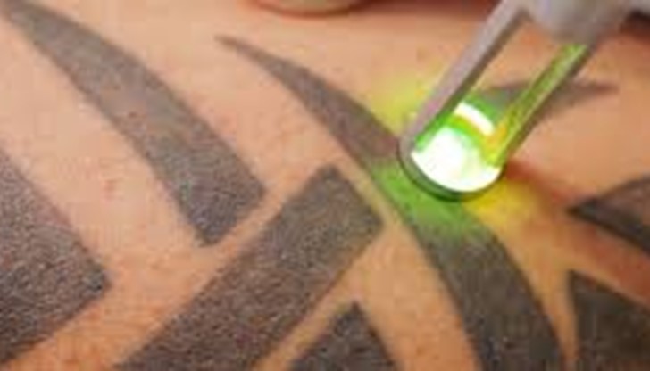 Всяка от процедурите продължава около 20 минути Всяка от процедурите продължава около 20 минути