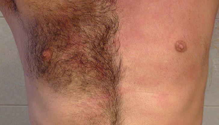 Космите, които се намират от врата надолу ... Космите, които се намират от врата надолу ...