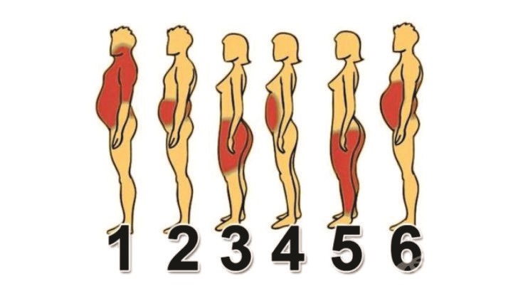 Противно на общоприетото мнение, затлъстяването идва в много различни форми Противно на общоприетото мнение, затлъстяването идва в много различни форми