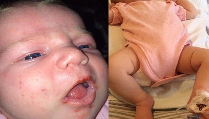 Млада майка иска да предупреди всички родители – когато позволявате на други хора да целуват бебето ви