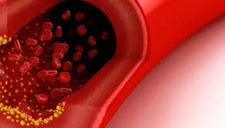 Когато няма възпаление, холестерол в кръвоносните съдове не се натрупва и може свободно да циркулира из тях