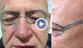 Мъж се събуди с татуирано лице след ергенски запой